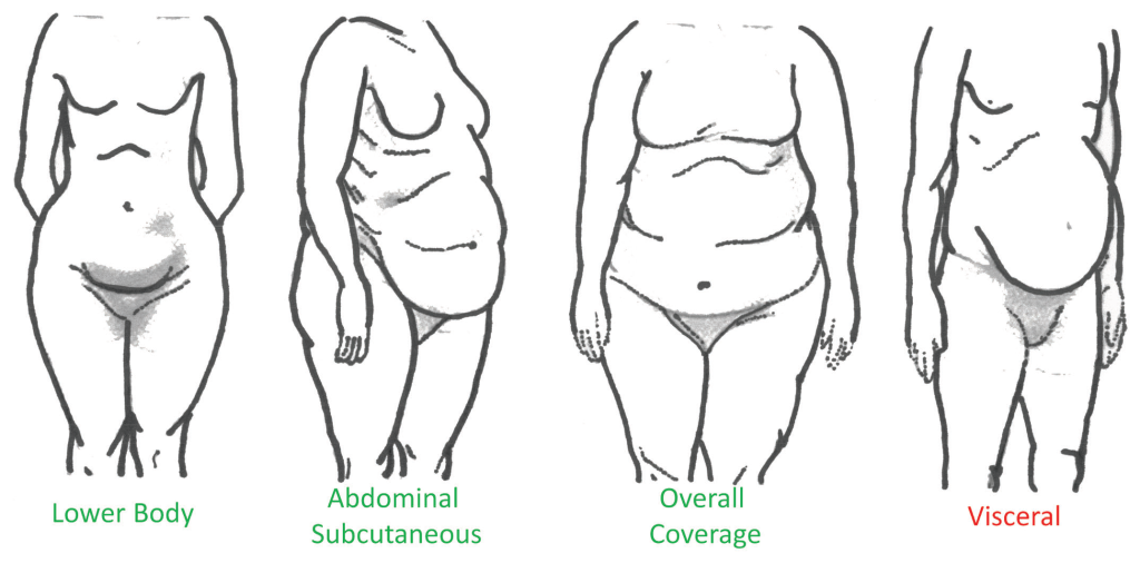 Figure 1. Types of body fat mass distribution [15]