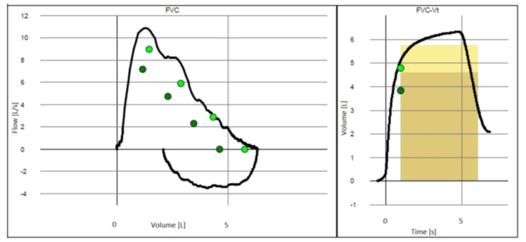 Measuring Thoracic Excursion: Reliability of the Cloth Tape Measure  Technique